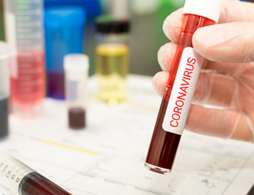 Impact of the Coronavirus on Global Supply Chain